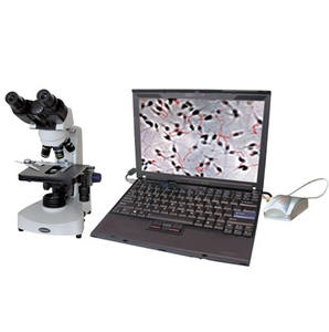 YSVET-SA68P 현미경 정자 분석기 수의학 정자 분석기 - Product Image 1