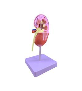 Mô hình bệnh lý thận người Mô hình giải phẫu thận bệnh lý quan điểm kép mô hình thận - Product Image 4