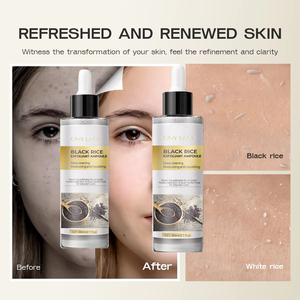 Gạo tẩy tế bào chết Ampoule đen & trắng gạo sáng cho làn da sáng nhẹ nhàng vỏ lỗ chân lông giảm thiểu & hydrat hóa sâu 80ml, 30ml - Product Image 4