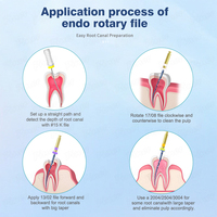 Juego de Limas de Endodoncia Activadas por Calor, Longitud de 19/21/25 mm, Material de Nitinol, Lima de Endodoncia Dental