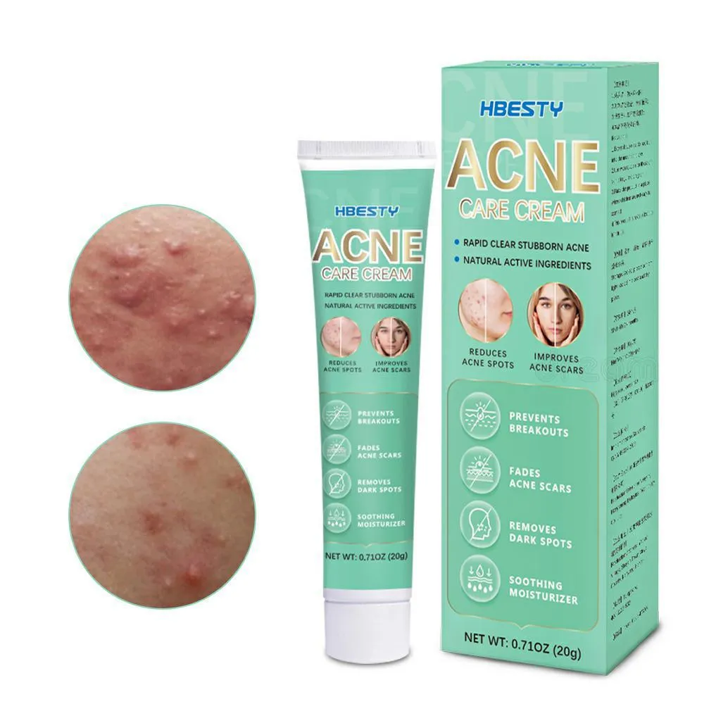 Private Label Herbal Natural Acne Treatment Scar Repair Pimple Removal Skin Brightening Gel Cream