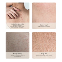 Spray corporel biologique MULAN - Vente en gros, exfoliant, nourrissant, blanchissant, hydratant pour l'acné du dos, peau rugueuse et grasse