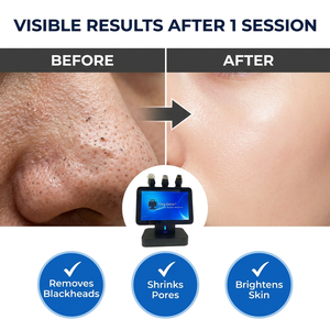 Cápsulas de Oxigenación con Burbujas de CO2 para Máquina Facial de Oxígeno, Limpieza Profunda, Hidratación, Cuidado de la Piel, Suministros para Salón de Belleza - Product Image 2