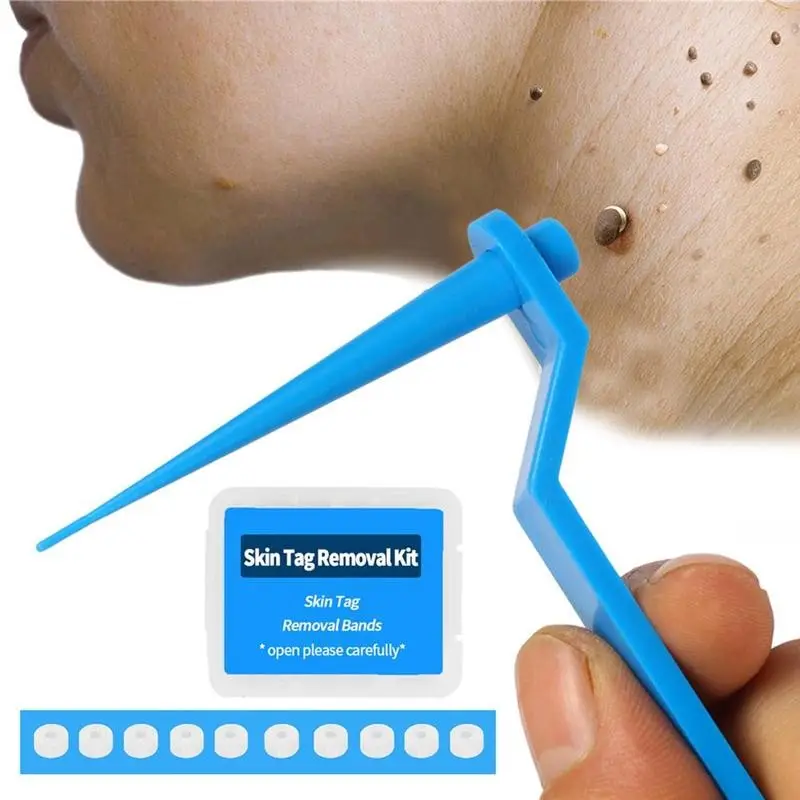 Micro removedor de verrugas, kit de remoção de marcas de pele para remoção de verrugas e cotonetes, adulto, 1 conjunto