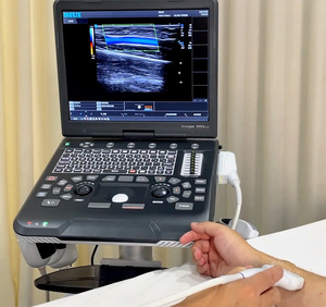 Ecógrafo Veterinario SIUI Apogee 1000 Lite, el Más Vendido, Portátil, con Doppler a Color y Pantalla de 15 Pulgadas - Product Image 3