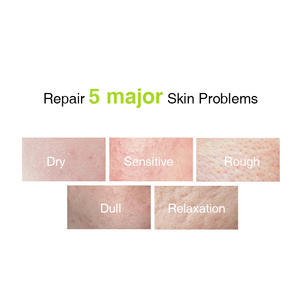 Crema facial antienvejecimiento para el acné, removedor de manchas oscuras, blanqueamiento de la piel negra - Product Image 4