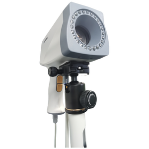 Colposcopio Digital con Certificación CE USA 510K para <span class=keywords><strong>Examen</strong></span> Cervical, Colposcopio de Video de Alta Resolución con Zoom Óptico de 18X KN-2200 - Product Image 5