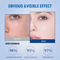 Sérum Facial en Gros PDRN ADN de Saumon Soin Spa Anti-Âge Anti-Rides Réparateur Niacinamide Ampoule Éclaircissante Usage Professionnel en Salon