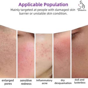 Máquina Integral de Gestión de la Piel con Burbujas de Agua y Aire No Invasiva, Máquina de Belleza Dedicada para Salón de Belleza - Product Image 4