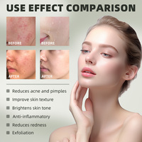 Fabricants Marque privée Vitamine B5 Réparation rapide Boost de la barrière cutanée Sérum à l'acide azélaïque pour le visage