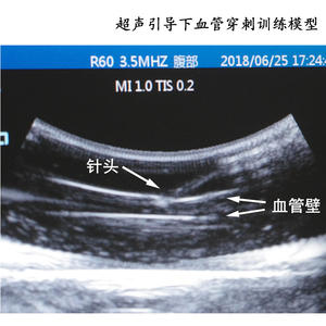 Modelo de Punción Vascular para Ciencias Médicas, Modelo de Punción Vascular Guiada por Ultrasonido para Enseñanza y Entrenamiento - Product Image 5
