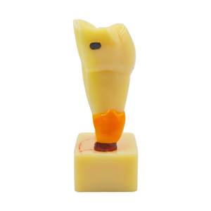 Gelsonlab HSDT-C17 4 Vezes a doença periodontal Modelo Dos Dentes - Product Image 4