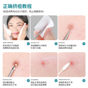 GECOMO เครื่องกำจัดสิวเสี้ย<span class=keywords><strong>น</strong></span>สแตนเลสสำหรับการดูดสิวเสี้ยนอ<span class=keywords><strong>ย</strong></span>่างแม่<span class=keywords><strong>น</strong></span>ยำและทำความสะอาดรูขุมข<span class=keywords><strong>น</strong></span>บนใบหน้า - Product Image 6