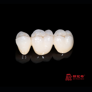 Dentisterie Esthétique Chine Dentaire <span class=keywords><strong>Prix</strong></span> Usine Dents Artificielles Personnalisé Pfm Dentaire Métal <span class=keywords><strong>Céramique</strong></span> <span class=keywords><strong>Couronne</strong></span> - Product Image 6