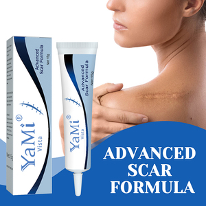 <span class=keywords><strong>Crema</strong></span> Corpo Private Label <span class=keywords><strong>per</strong></span> la Rimozione di <span class=keywords><strong>Cicatrici</strong></span> <span class=keywords><strong>da</strong></span> Acne, Smagliature e Ustioni su Viso e Gambe - Product Image 5