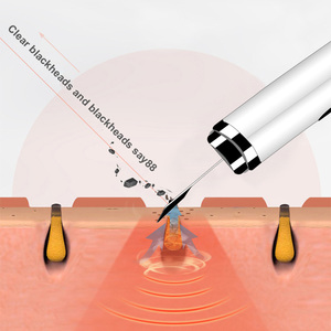 Depurador facial de limpieza profunda ultrasónica, espátula eléctrica para el cuidado de la salud, Material ABS con puntas estándar Nano, exfoliante de poros - Product Image 3