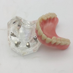 Modelo de cirugía dental y oral para nuevos productos de ciencia médica de implantación y Prostodoncia - Product Image 3