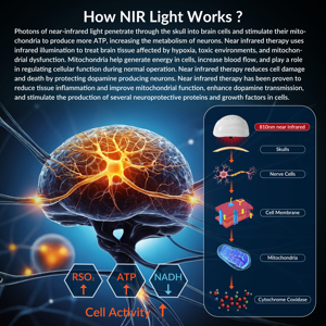 Casco de Fotobiomodulación con Luz Infrarroja Cercana (NIR) de 1070nm para <span class=keywords><strong>Migraña</strong></span>, Depresión, <span class=keywords><strong>Ansiedad</strong></span>, Accidente Cerebrovascular y Alzheimer - Product Image 2