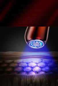 Dispositivo de Masaje Facial OEM de Fábrica, Luz Roja, Infusión, Lifting Facial, Contorno, Recargable, Instrumento de Belleza para Uso Doméstico - Product Image 6