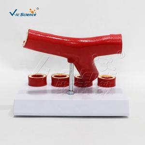 Y-образная модель атеросклероза артерии раздельная модель тромба анатомические модели анатомических моделей сосудов кровеносных сосудов - Product Image 5