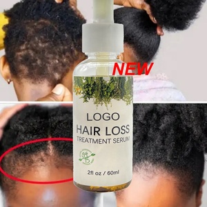Marque privée personnalisée 100% sérum de soin du cuir chevelu biologique naturel huile essentielle de traitement des cheveux au romarin pour les femmes - Product Image 1