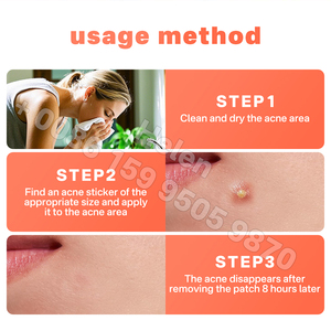 פצעון hydrocolloid להתאמה אישית תיקוני אקנה תיבת לוגו-תיקונים צבעוניים אקנה עם יהלום - Product Image 6