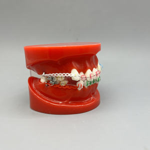 Sistema di Simulazione Dentale Ortodontica con Denti in Resina, Quattro Brackets Premolari, Filo di Legatura, Modello Anatomico per Scienza Medica - Product Image 2