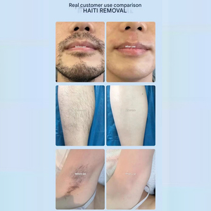 Machine laser à diode professionnelle à 3 longueurs d'onde, <span class=keywords><strong>grande</strong></span> puissance, 2000 W, épilation avec technologie <span class=keywords><strong>de</strong></span> refroidissement par <span class=keywords><strong>glace</strong></span>, resserrement <span class=keywords><strong>de</strong></span> la peau, <span class=keywords><strong>salon</strong></span> - Product Image 5