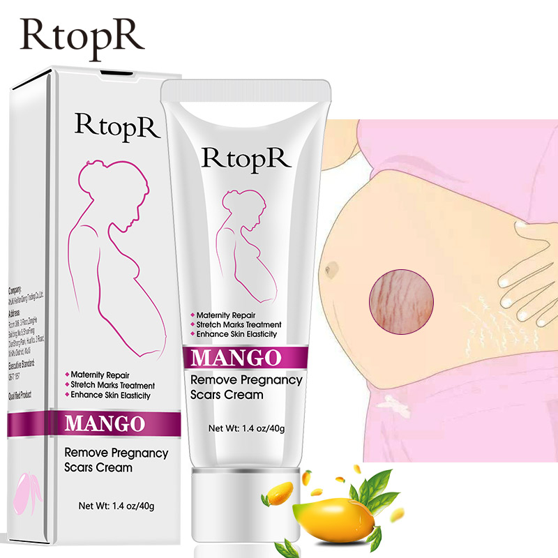 RtopR Amazon Hot Sale Mango Extract Stretch Marks Scar Removal Cream