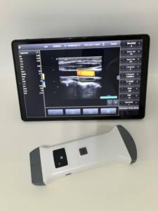 プロ仕様のワイヤレス凸プローブとリニアアレイプローブ2 in 1カラードップラー超音波プローブ - Product Image 2