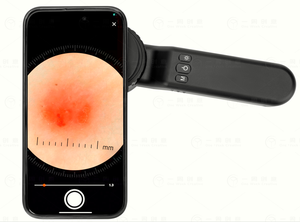 IBOOLO DE-4100 dokter dermatoskop 10X perbesaran cahaya terpolarisasi kompatibel dengan telepon - Product Image 5