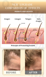 Aceite para el Crecimiento del Cabello OTVENA - Fortalece las Hebras y Reduce la Rotura - OEM/ODM - Product Image 4