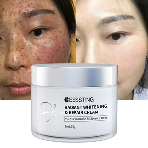 Crema Blanqueadora Facial Potente para Eliminar Pecas, Melasma, Manchas de Pigmento, Melanina y Manchas Oscuras, Venta Caliente - Product Image 1