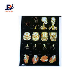 فيلم الأشعة السينية للبيع - Product Image 2