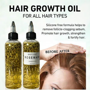 Minyak esensial Rosemary organik suplemen penumbuh rambut perawatan kulit kepala Herbal Biotin minyak esensial penipis rambut minyak rambut alami - Product Image 3
