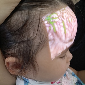 Produsen anak-anak Harga pencari pembuluh inframerah dengan keranjang genggam - Product Image 3