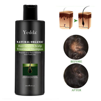 Esensi Penumbuh Rambut Universal untuk Pria dan Wanita. Produk Perawatan Rambut Anti-Rontok Herbal Organik yang Menutrisi.