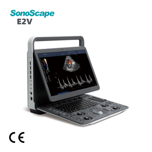 เครื่องอัลตราซาวด์สีแบบพกพา Sonoscape E2V สำหรับสัตวแพทย์ - Product Image 1