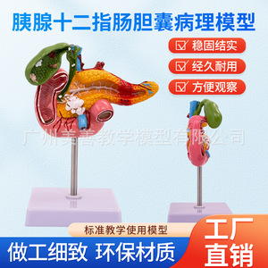 Modèles pathologiques simulés du pancréas, du duodénum et de la vésicule biliaire ; enseignement des spécimens du système digestif, y compris - Product Image 4