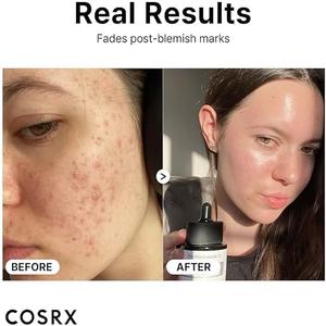 ไนอาซินาไมด์ 15 เซรั่ม 20 มล. รีไฟน์ พอร์ส - Product Image 3