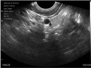 B26D <span class=keywords><strong>DICOM</strong></span> portable 2 en 1 couleur Portable Doppler USG pour examen vaginal détaillé de l'abdomen profond échographie sans fil Portable - Product Image 5