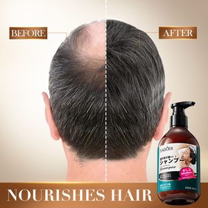 Shampoo anti-chute de cheveux SADOER, nettoie et élimine les pellicules avec une mousse douce <span class=keywords><strong>qui</strong></span> n'irrite pas <span class=keywords><strong>le</strong></span> <span class=keywords><strong>cuir</strong></span> <span class=keywords><strong>chevelu</strong></span> - Product Image 3