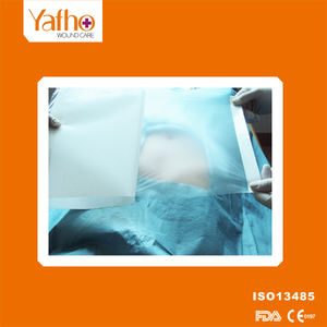 Grosir kelas medis pelindung PE/PU steril Incise Drape <span class=keywords><strong>film</strong></span> transparan berpakaian - Product Image 4