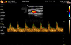 Laptop Full Digital Ultrasound Scanners Ultrassom Portátil Doppler Colorido - Product Image 3