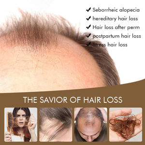 Personalizzato organico naturale dritto Anti perdita di capelli cura crescita riparazione propria etichetta olio di ricino siero per la crescita dei capelli - Product Image 4