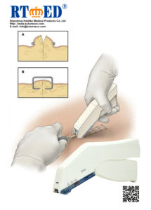 Agrafeuse de peau jetable de fermeture de blessure pour l'usage chirurgical - Product Image 2