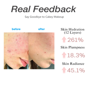 Suero de Burbujas de Colágeno Rosa PDRN de 95 g |   Suero Facial Hidratante Antiarrugas con 99% de Pureza de PDRN y Colágeno de Bajo Peso Molecular - Product Image 2