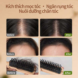 Aceite Orgánico <span class=keywords><strong>de</strong></span> 30ml para el Crecimiento del Cabello con Sésamo Negro y <span class=keywords><strong>Romero</strong></span>, Suero Natural a Base <span class=keywords><strong>de</strong></span> Hierbas y Jengibre Contra la Caída del Cabello para Cabello Fino y Escaso - Product Image 5