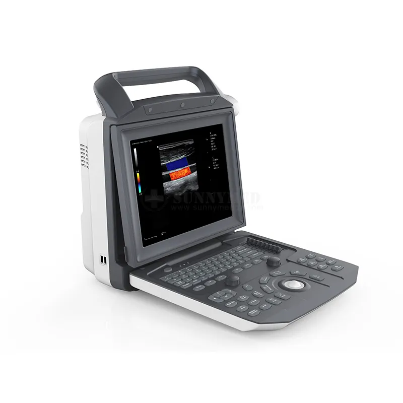SYA-M5 Zoncare m5 3d נייד רפואי ecografo אולטרה סאונד צבע וטרינרי מערכת אולטרסאונד דופלר