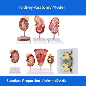 Modelo de anatomía renal ampliado, glándulas suprarrenales, riñón enfermo, modelo anatómico de órgano interno humano para escuelas de ciencias médicas - Product Image 5